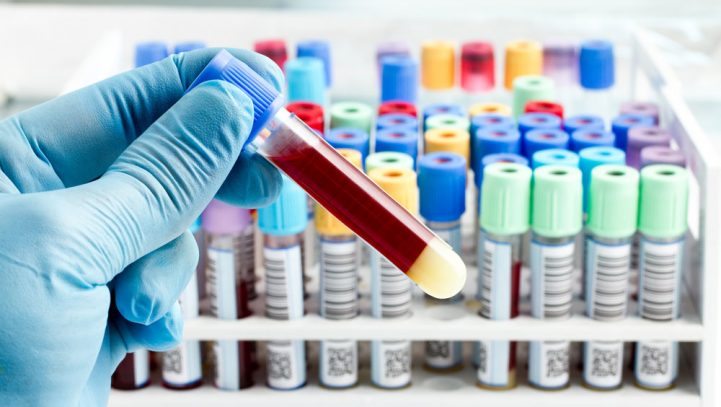 Promising New Methods of Mesothelioma Diagnosis Promising New Methods of Mesothelioma Diagnosis