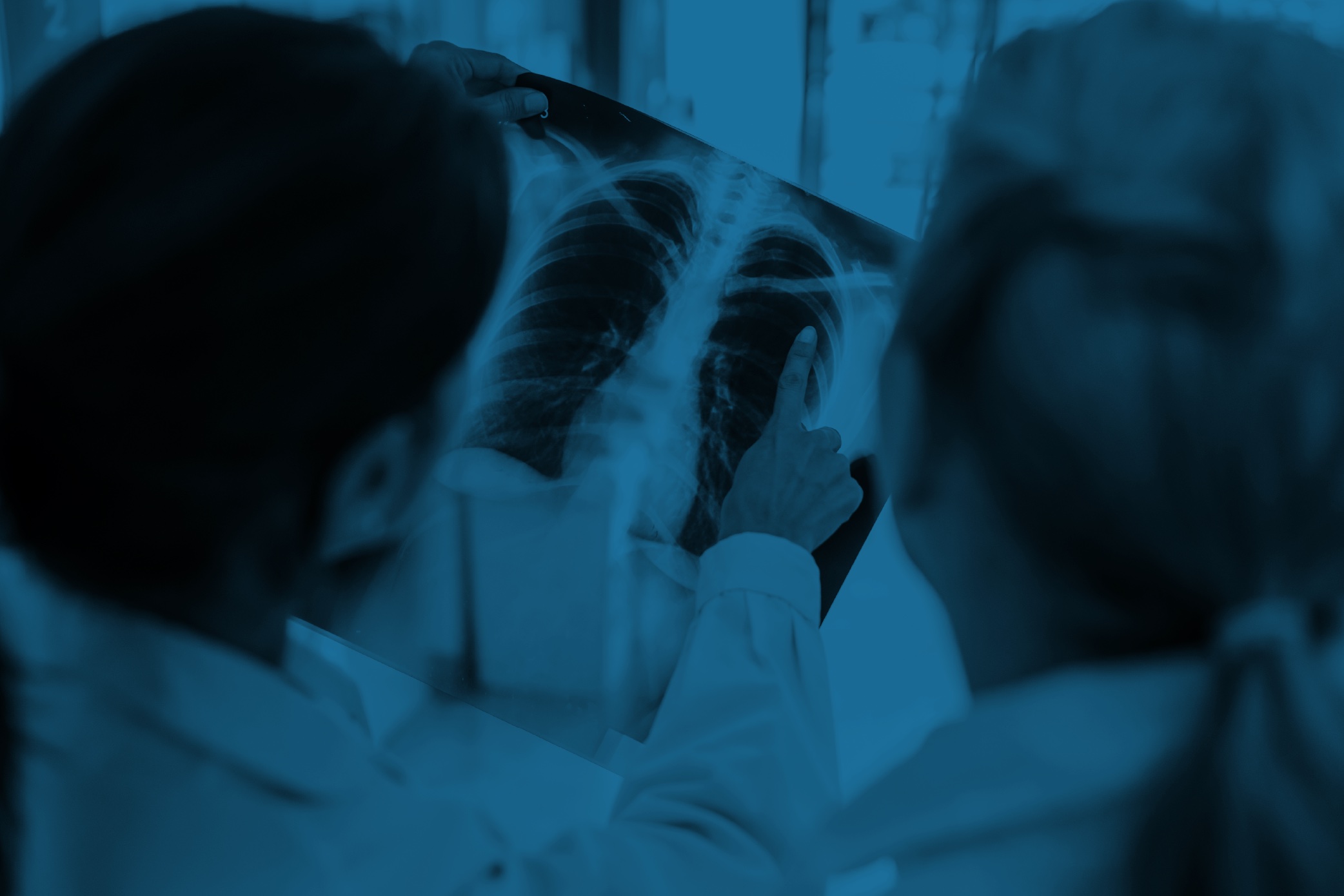 What to Know About Filing a Mesothelioma Lawsuit